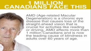 How AMD Affects Central Vision