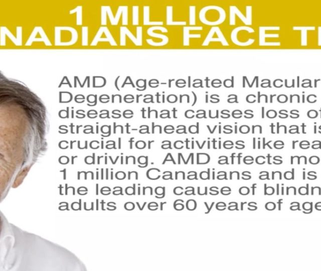 How AMD Affects Central Vision